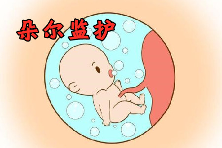 朵尔监护胎心监护app